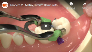 Triodent V3 Matrix System